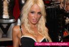 Page 3 girl Rhian Sugden has her 34HH boobs reduced as Corrie star husband gutted